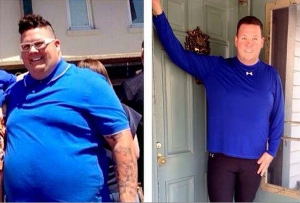 Elliot prima e dopo l'operazione