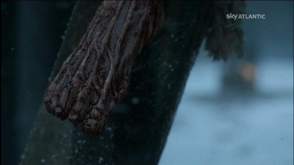 Il piede scuoiato della vecchia